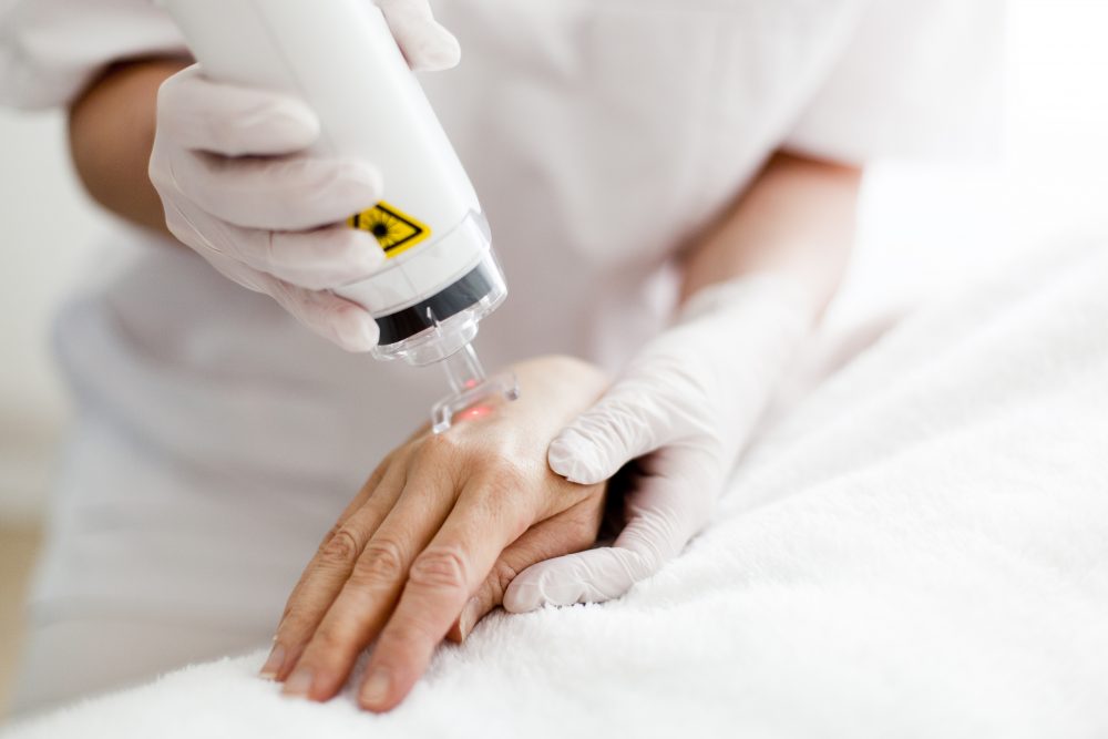 EDA-Simulation in der Dermatologie unterstützt den Lasereinsatz für bspw. Hautbehandlungen.
